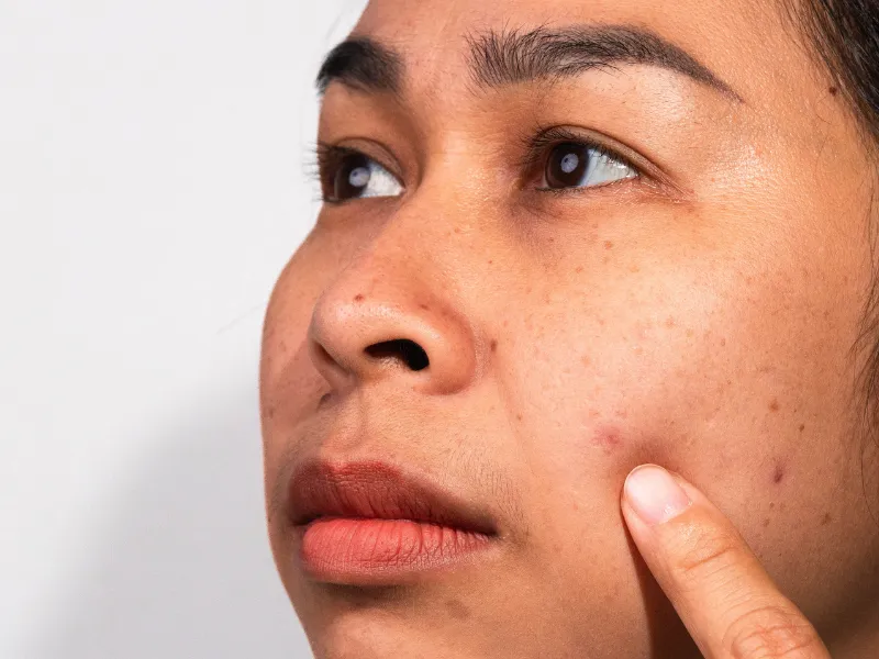 Những hiểu lầm thường gặp về dimethicone trong mỹ phẩm