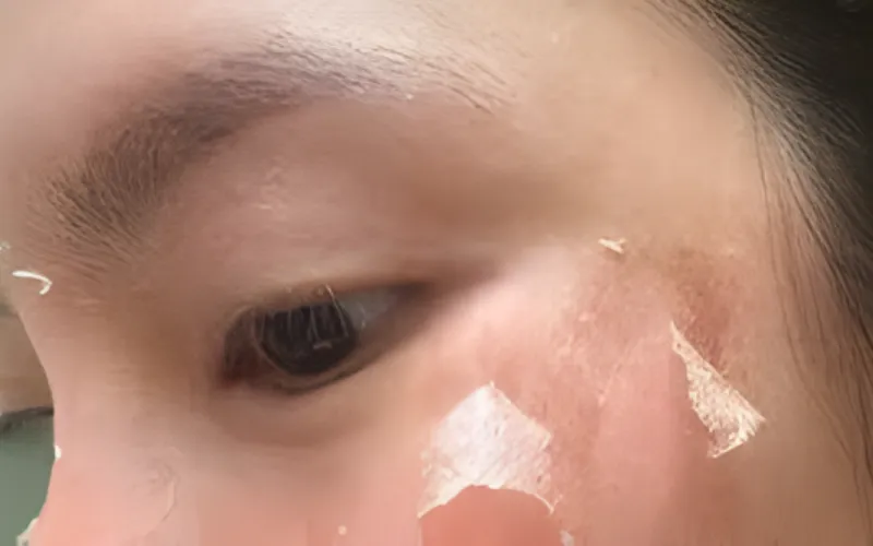 Tránh lạm dụng sản phẩm lột tẩy mạnh