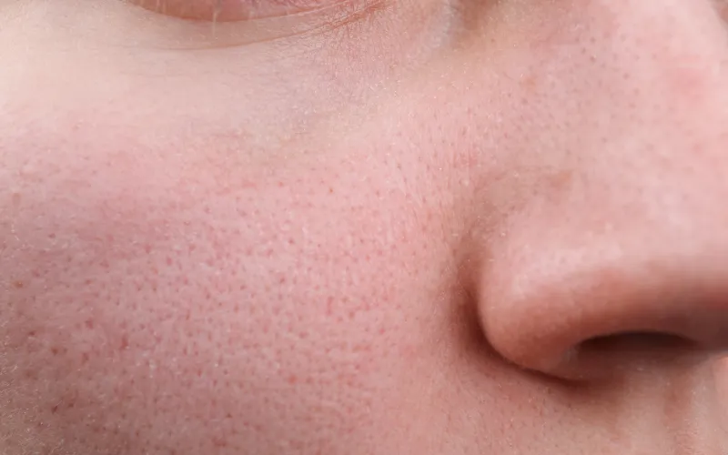 Đối với làn da khô và da nhạy cảm