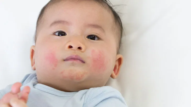 mặc quần áo thoáng mát