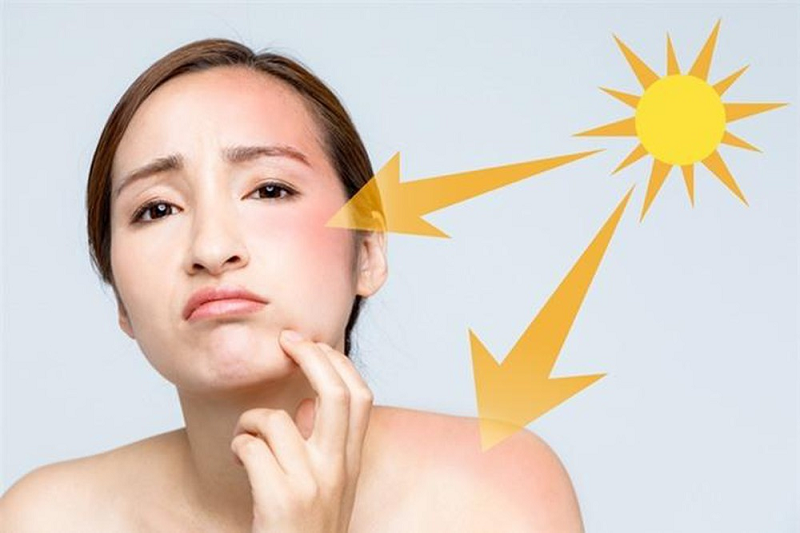 da mặt nhạy cảm dễ nổi mụn