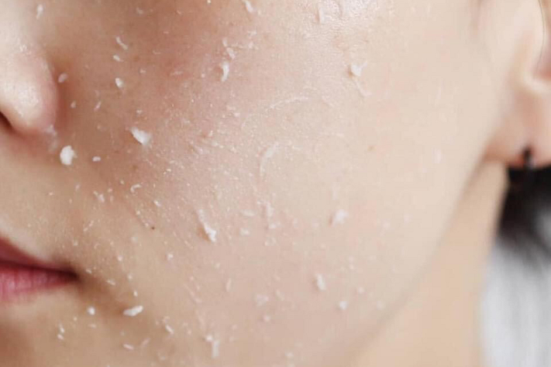 da nhạy cảm nên dùng gì