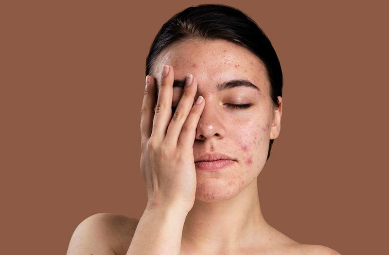 da nhạy cảm nên dùng gì