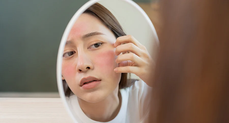 da nhạy cảm nên dùng gì