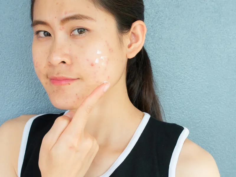 Hướng dẫn cách chăm sóc da khi đến tháng