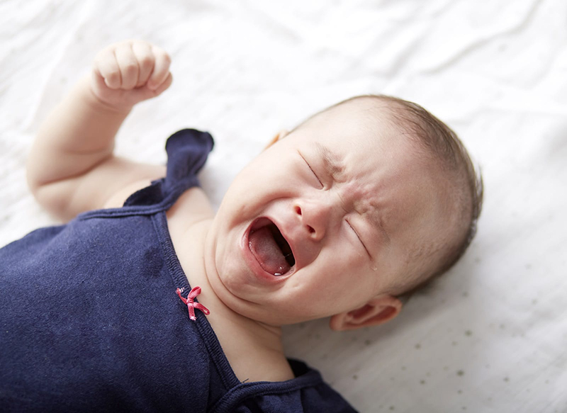 hình ảnh rôm sảy ở trẻ sơ sinh