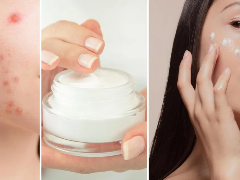 Giữ da đủ ẩm và không dùng quá nhiều sản phẩm treatment cùng lúc
