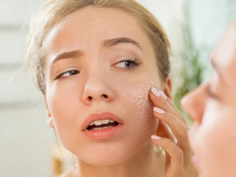 Cần tránh các hoạt chất treatment mạnh