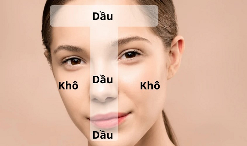sodium cocoyl isethionate là gì
