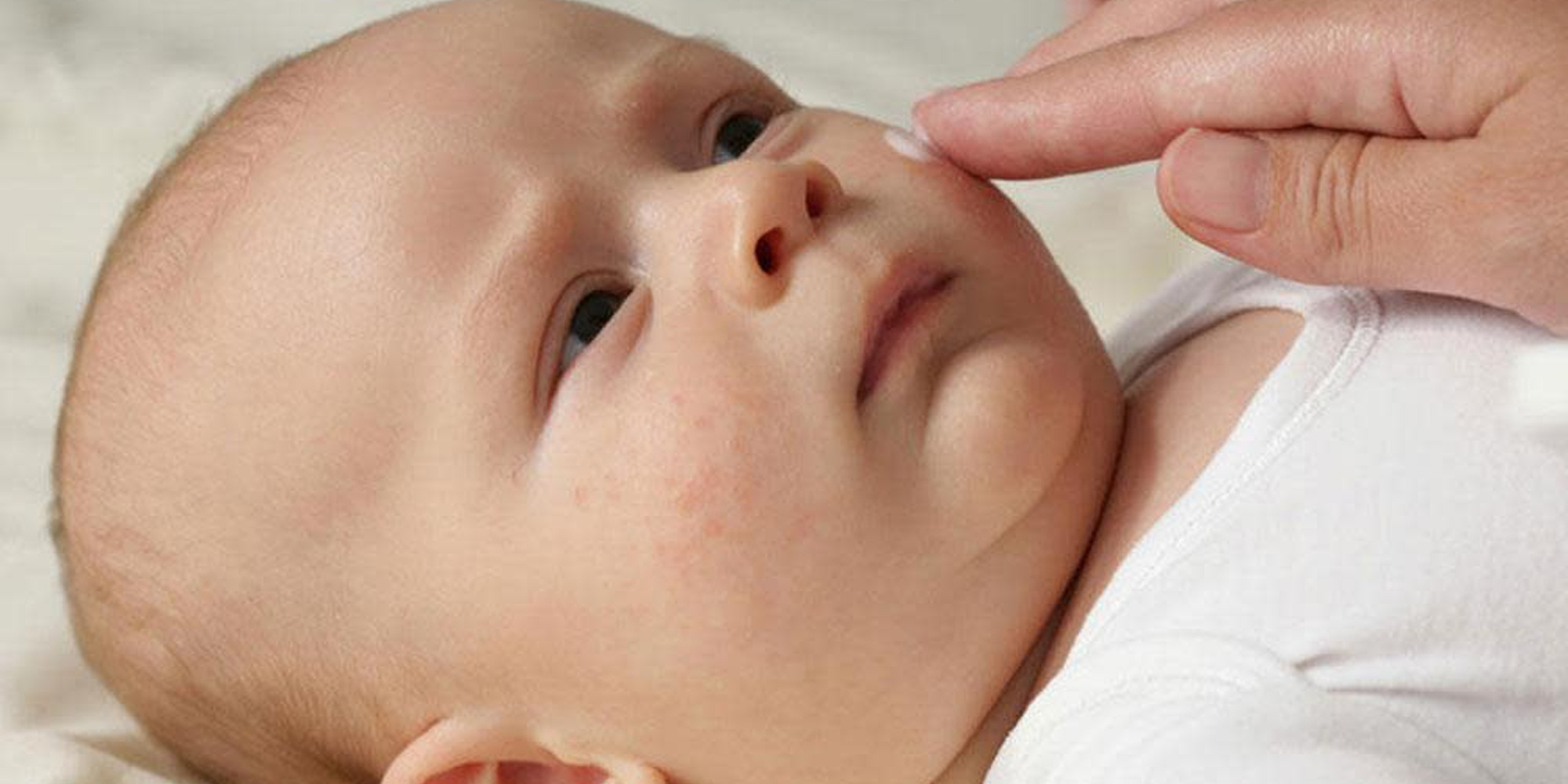 trẻ sơ sinh nổi mẩn đỏ ở mặt
