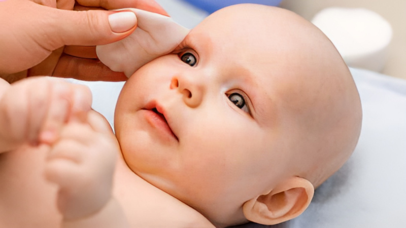 trẻ sơ sinh nổi mẩn đỏ ở mặt