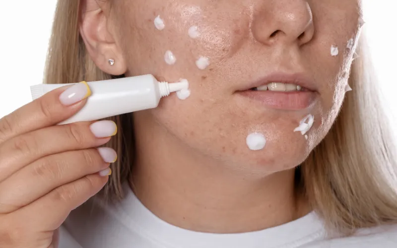 Benzoyl Peroxide