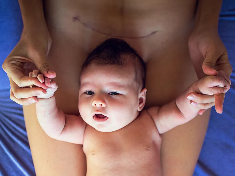 Tầm quan trọng của cách vệ sinh vùng kín sau mổ