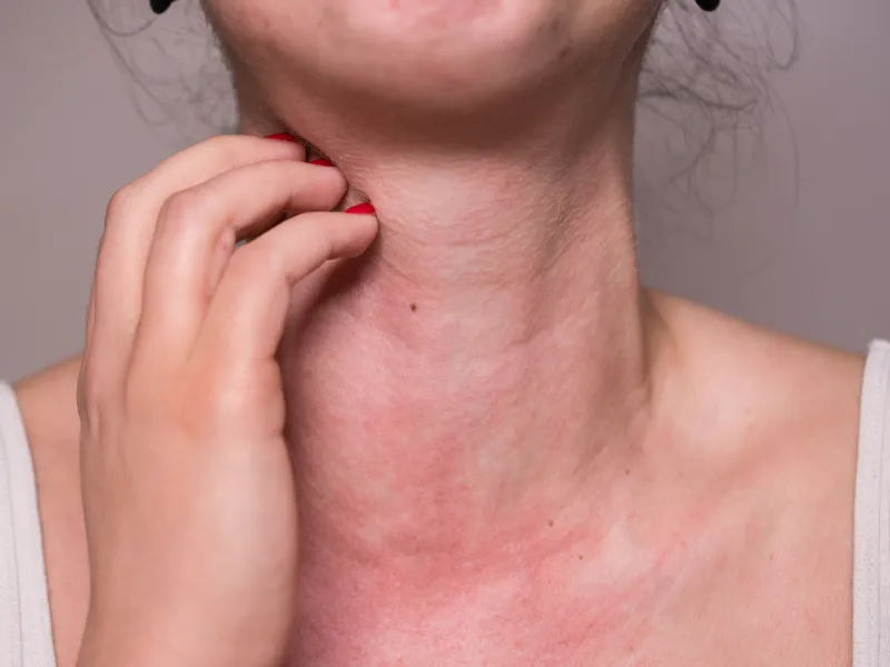 Da dễ phản ứng với môi trường và mỹ phẩm
