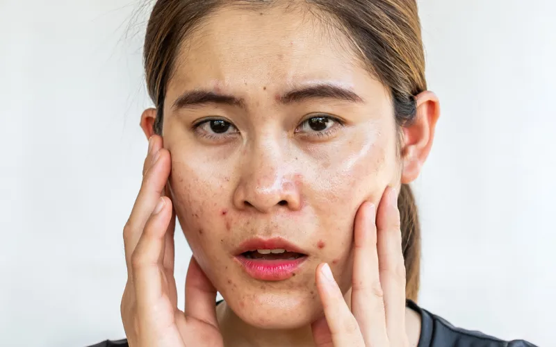Giải đáp các câu hỏi về làm trắng da