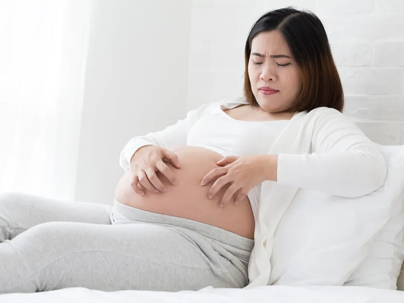 Mẹ bầu dễ bị rôm sảy là do thân nhiệt tăng cao, sự thay đổi nội tiết tố và lượng máu tăng lên.
