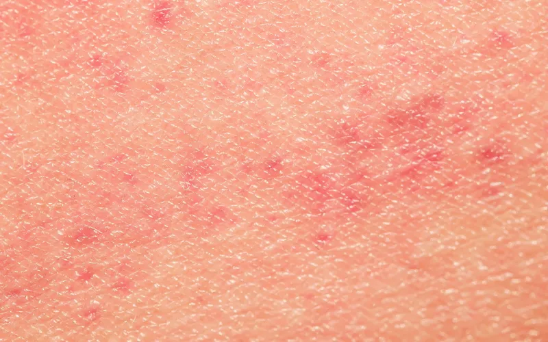 tác dụng của vitamin c với da
