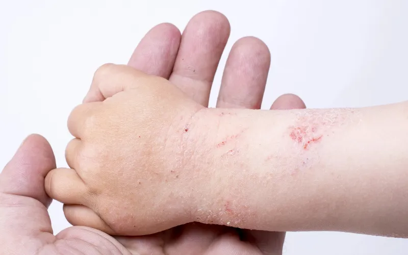 Đặc điểm làn da và tâm lý lựa chọn lá tắm cho trẻ