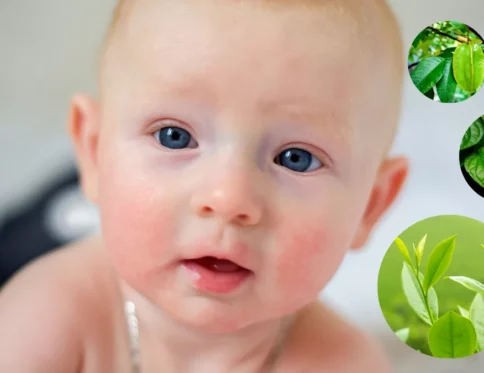 Trẻ bị viêm da cơ địa tắm lá gì?