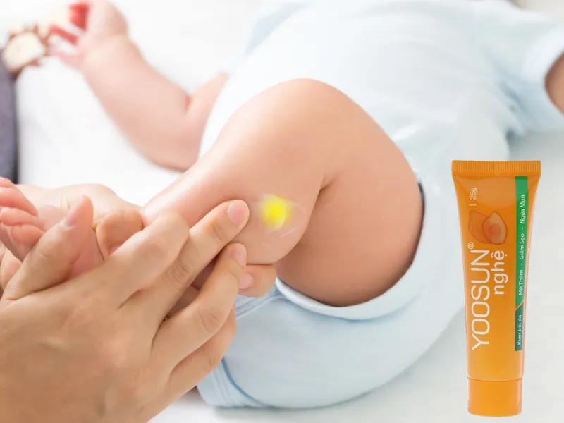 Yoosun Nghệ có dùng được cho trẻ em không?