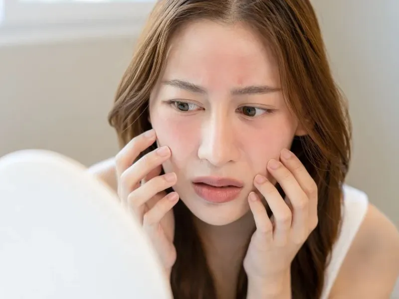 Tại sao dùng sữa rửa mặt bị rát?