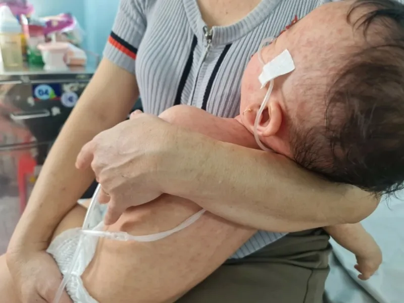 Phân biệt rôm sảy và sởi qua triệu chứng đi kèm