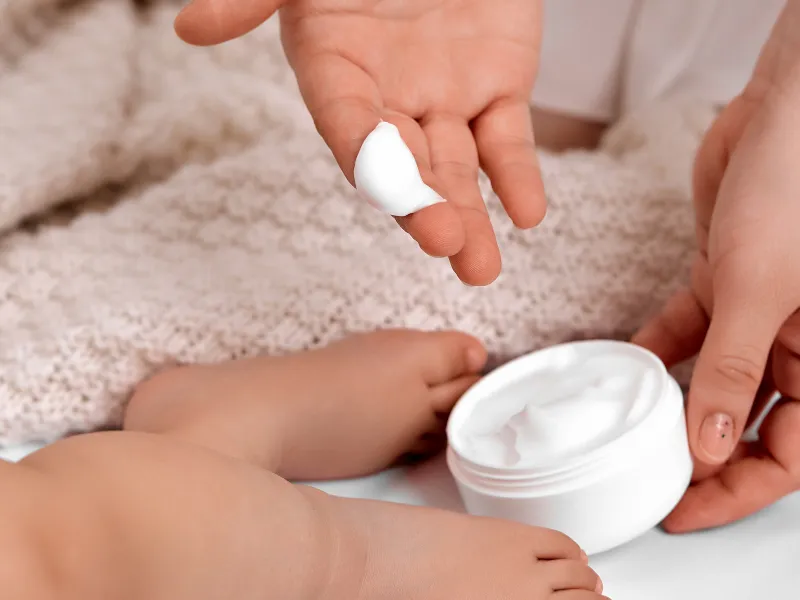 Hạn chế sử dụng các sản phẩm gây bí da