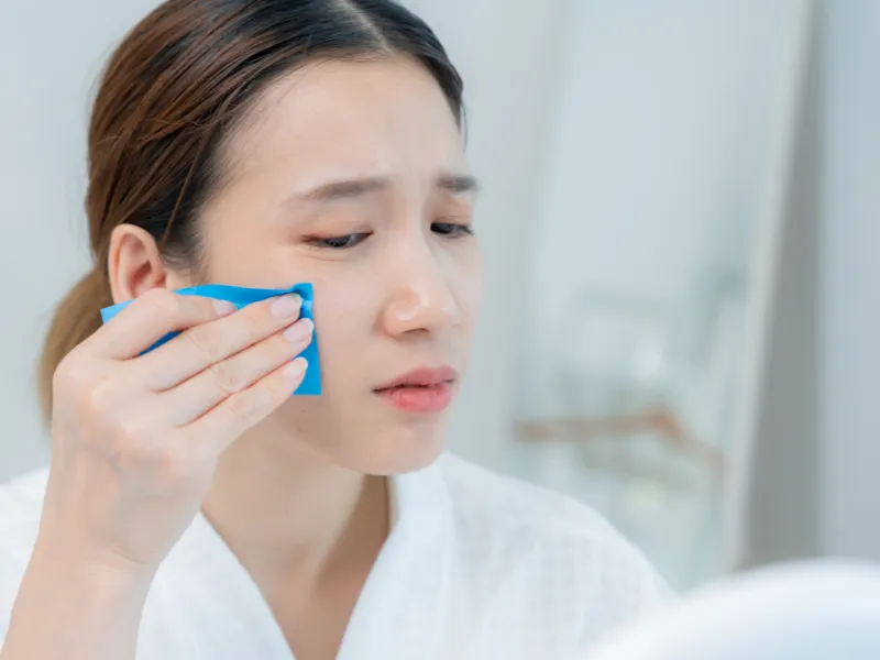 Người da dầu hoặc hỗn hợp thiên dầu