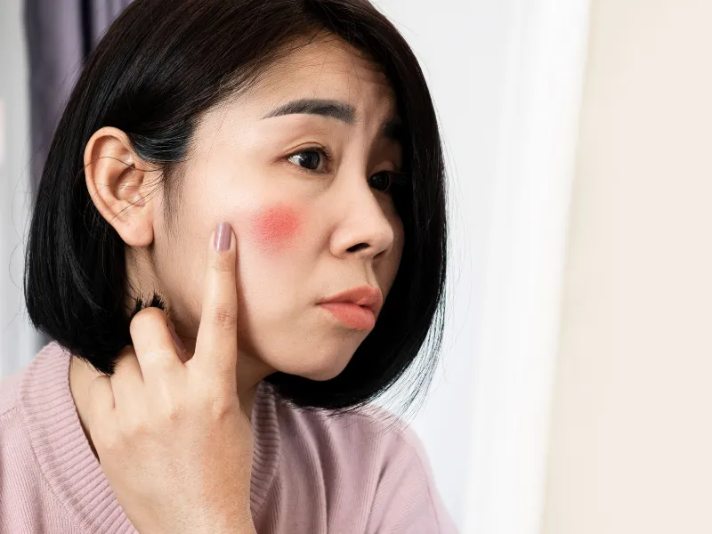Người đang gặp các bệnh lý da liễu