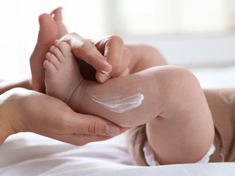 Cách bôi dưỡng ẩm cho trẻ viêm da cơ địa đúng cách