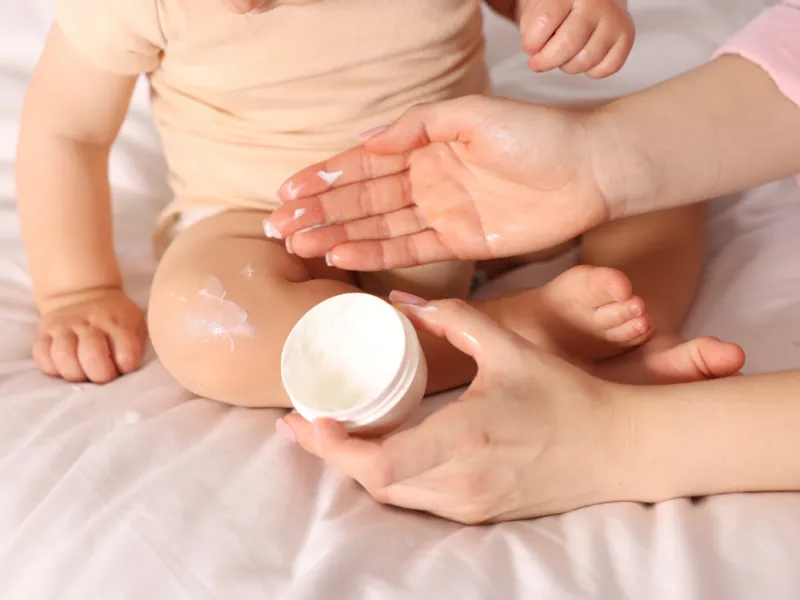 Bé bị viêm da cơ địa nên bôi gì?