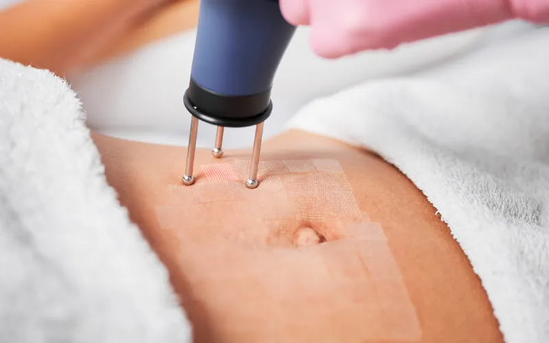 Bước 4: Cân nhắc các phương pháp chăm sóc chuyên sâu khi cần thiết
