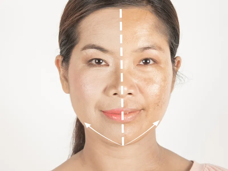 Me sau sinh da mặt thường thâm sạm, xỉn màu