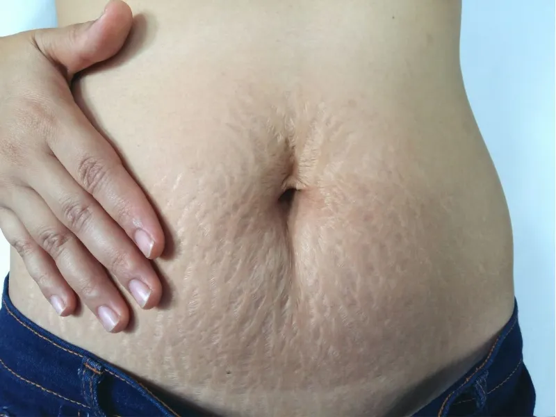 Mức độ hồi phục tùy thuộc vào nhiều yếu tố