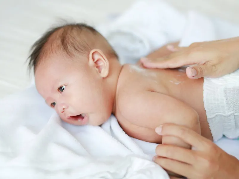 Dưỡng ẩm cho da bé bị cáy