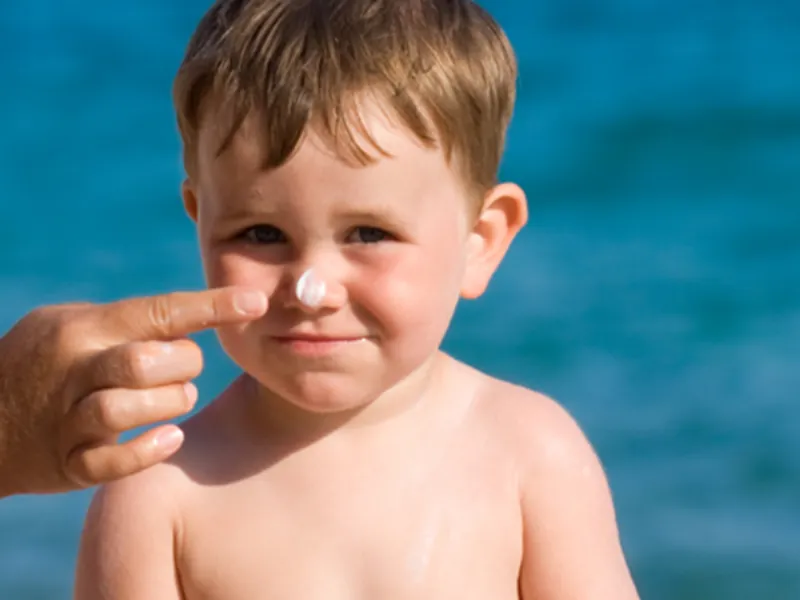 Ba mẹ có thể sử dụng kem dưỡng ẩm để làm dịu vết cháy nắng