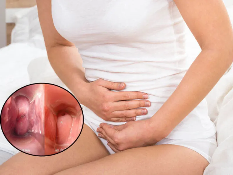 Không phải mọi thay đổi ở vùng kín đều là dấu hiệu mang thai.