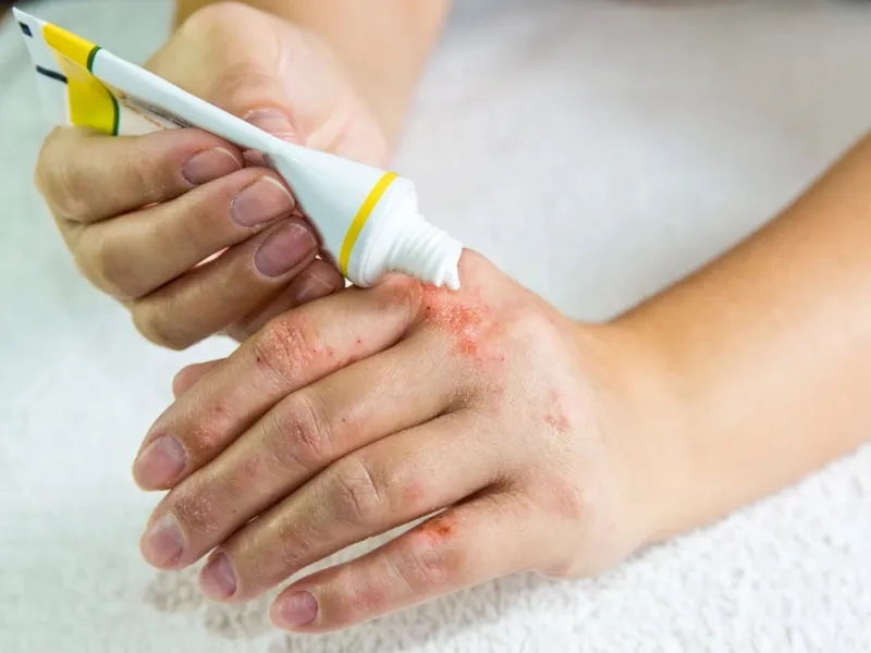 Cần sử dụng thuốc theo chỉ định của bác sĩ