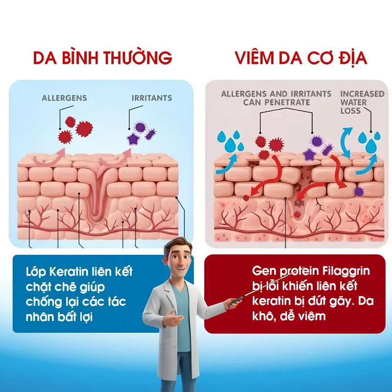 thay-doi-o-gen-filaggrin-khien-da-de-kho-va-nhay-cam-hon