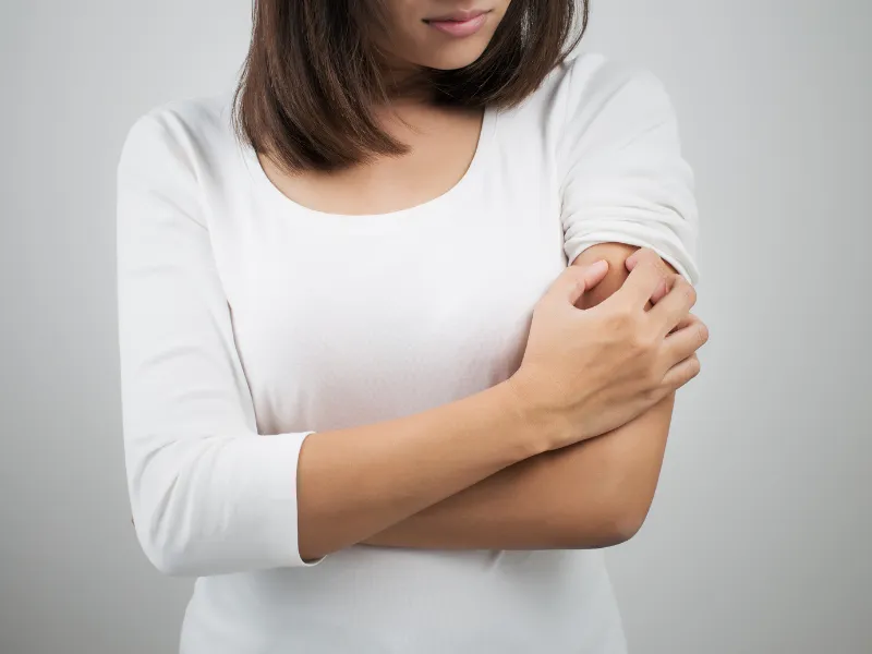 Vì sao nhiều người nhầm tưởng viêm da cơ địa có thể lây?