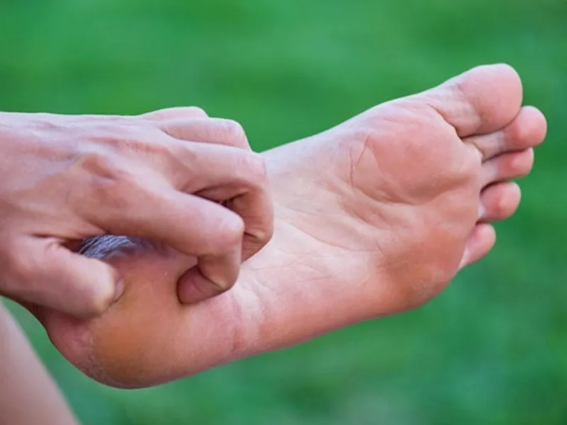 Các yếu tố môi trường cũng có ảnh hưởng đến sự xuất hiện và tiến triển của bệnh