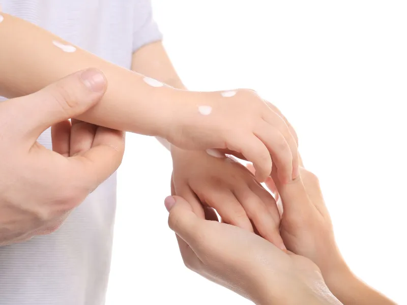 Có nên tự mua thuốc bôi cho em bé?