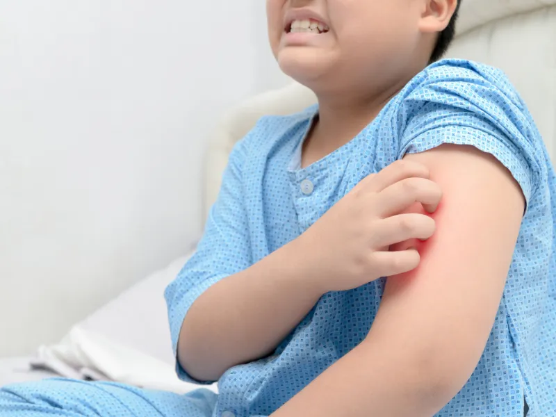 Nhiễm trùng da do gãi nhiều