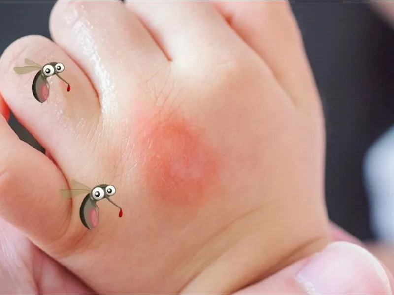 Hỗ trợ hạn chế côn trùng đốt