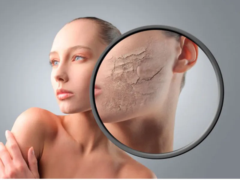 Da bị thiếu nước là nguyên nhân thường gặp nhất khiến da khô đổ dầu