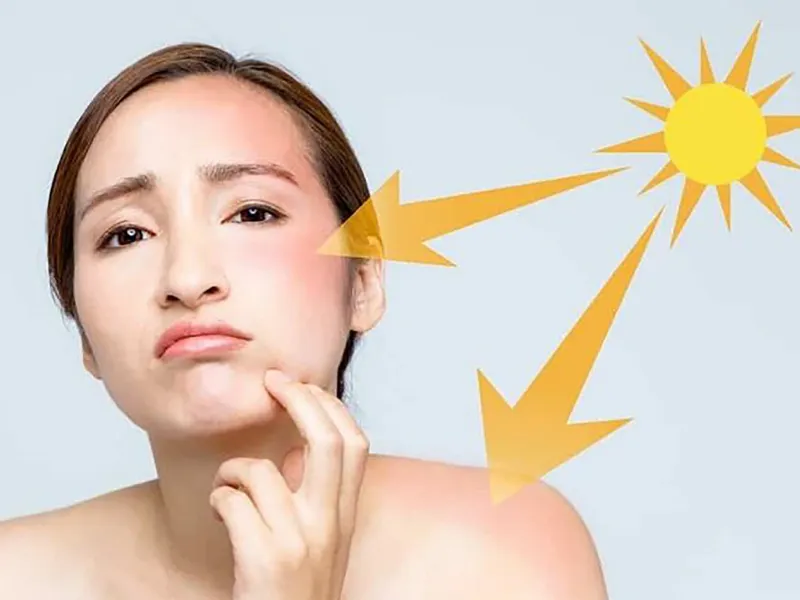 Da khô và nhăn nheo có thể do phải tiếp xúc nhiều với ánh nắng mặt trời