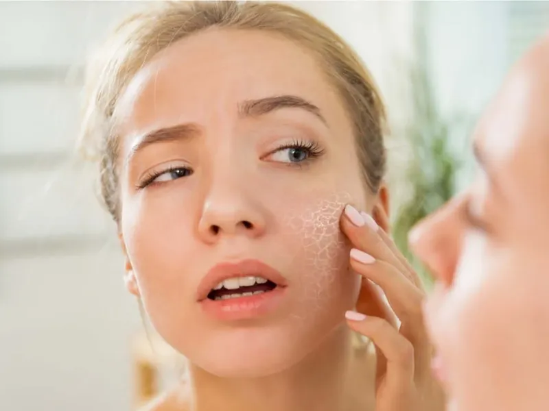 Lão hóa là một trong những nguyên nhân phổ biến khiến da mất độ đàn hồi và trở nên khô hơn