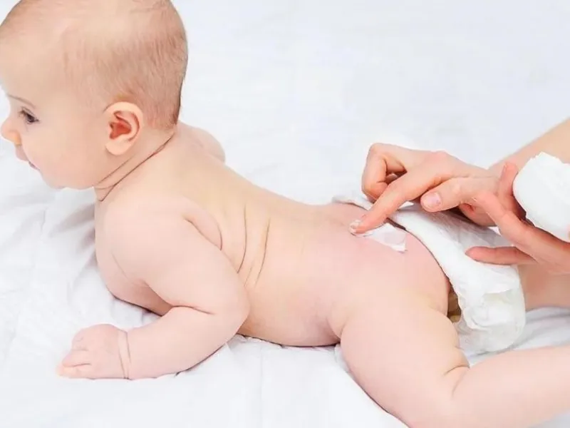 Sử dụng kem bảo vệ da cho trẻ