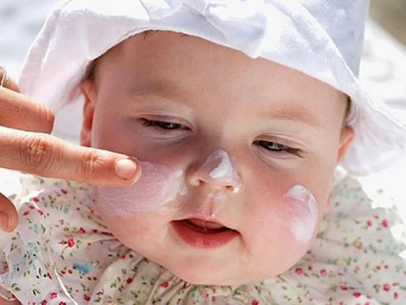 Khi bé bị chàm sữa, cha mẹ nên dưỡng ẩm đều đặn