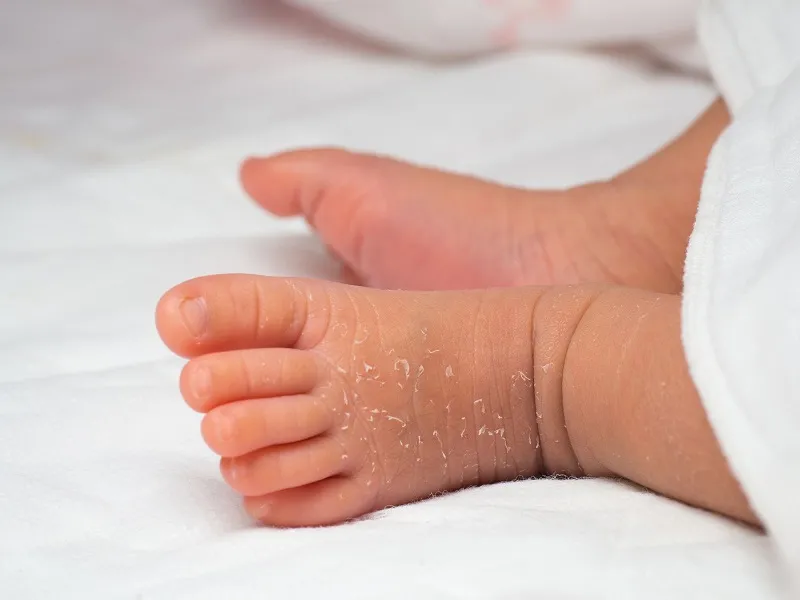 Nước tắm từ rau sam có thể giúp da bớt khô ráp, giảm bong tróc và duy trì độ mềm mại